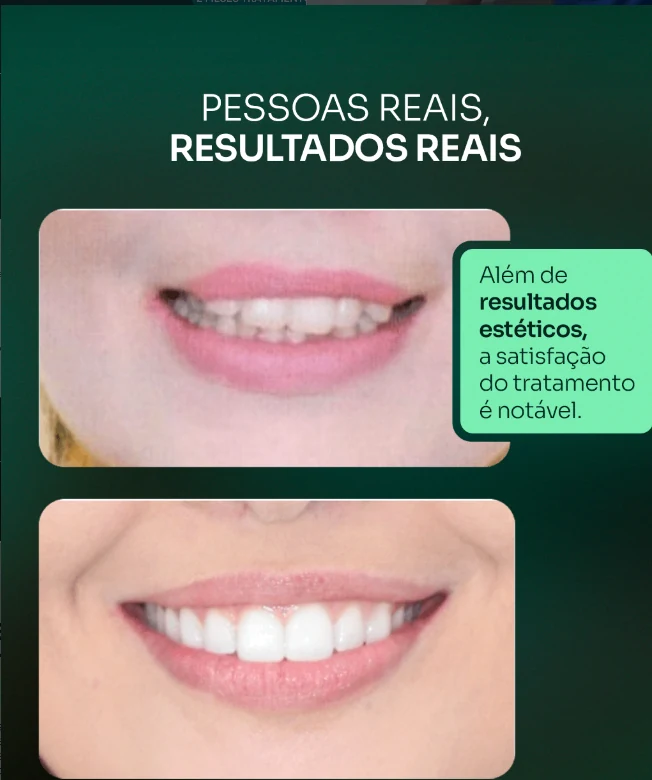 Resultado real divulgado pelo Dr Luís Fernando Goulart